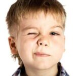 Nguyên nhân và cách chữa tật nháy mắt ở trẻ em